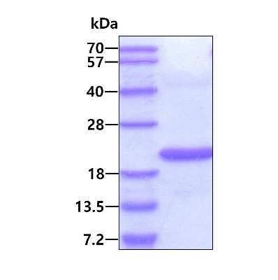 SDS-PAGE: Recombinant Human STAMP2/STEAP4 His Protein [NBP2-51607]
